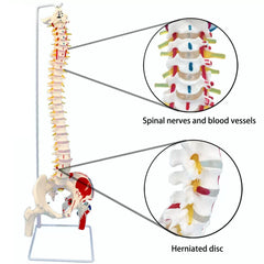 Flexible Spine Model With Femur Heads, Nerves, Occipital Plate And Painted Muscles Origins & Insertion Points