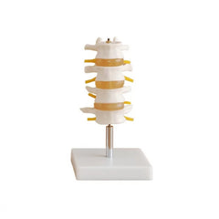 Lumbar Vertebrae Model (4pcs) Life Size