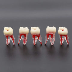 RCT Tooth Model (Root Canal Practice Model)