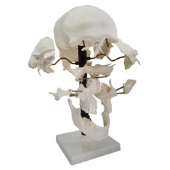 Exploded Human Skull Model