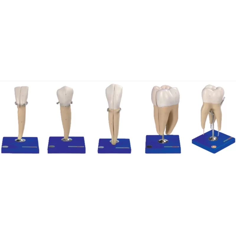 Lower Incisor, Canine, Molar With 1 Root & First Upper Molar With 3 Roots Model