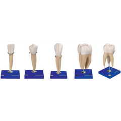 Lower Incisor, Canine, Molar With 1 Root & First Upper Molar With 3 Roots Model