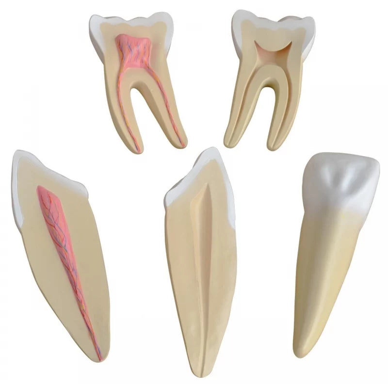 Teeth Expansion Model