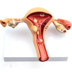 Uterus Ovary Model With Pathologies