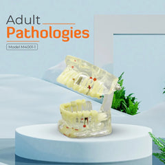 Dental Model With Pathologies (Transparent)