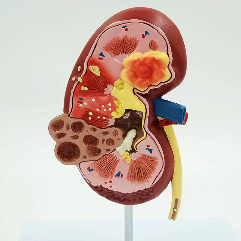 Human Kidney Model (All in One)