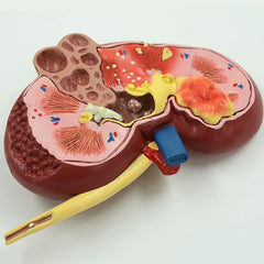 Human Kidney Model (All in One)