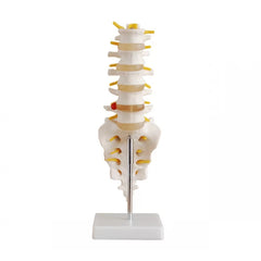 Lumbar Vertebrae With Sacrum, Coccyx and Herniated Disc (Life-Size) Anatomical Model