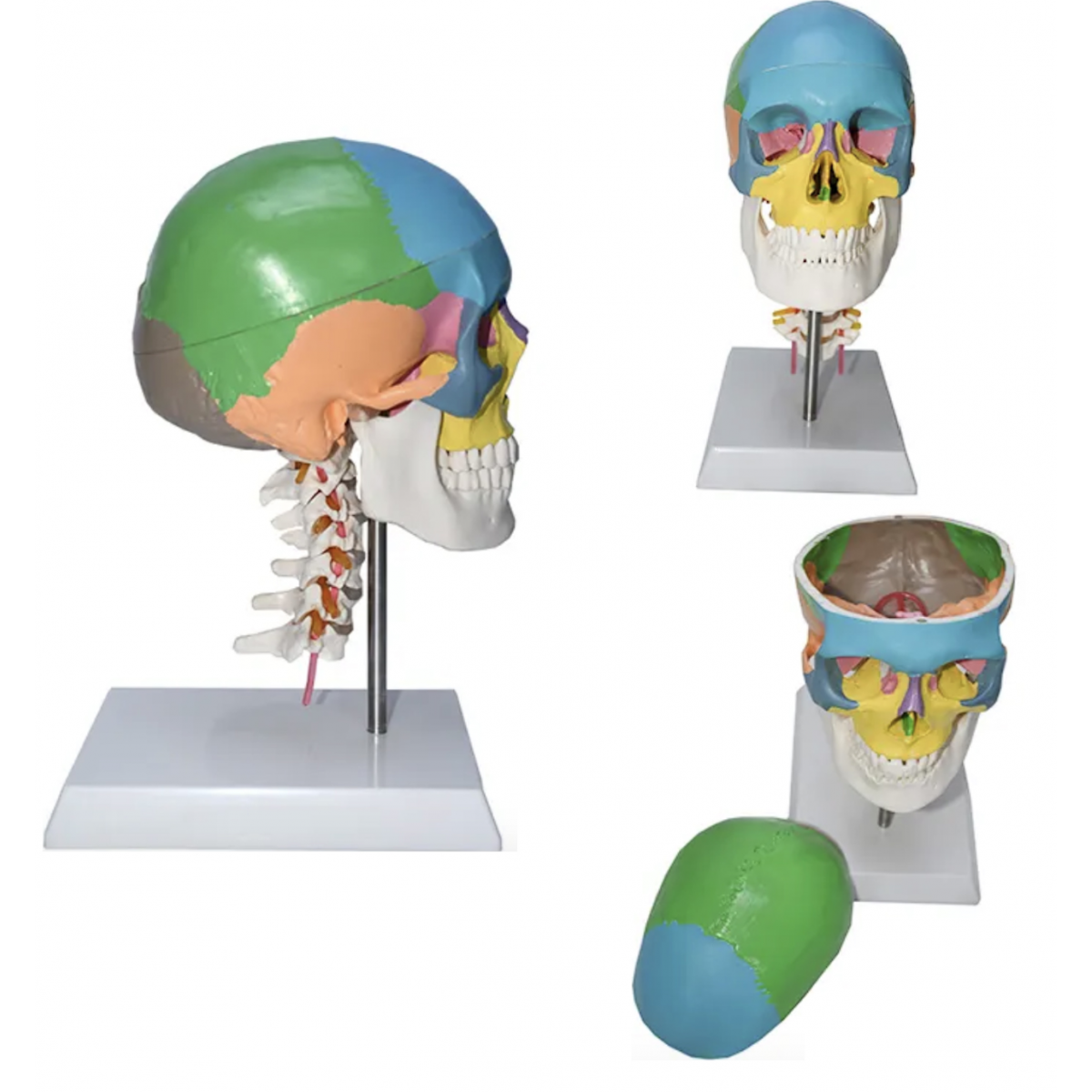 Coloured Skull With Cervical Model